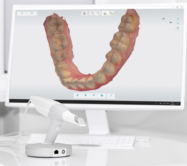 Morrisville 3D Cone Beam and 3D Dental Scans