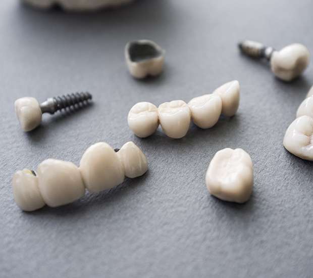 Morrisville The Difference Between Dental Implants and Mini Dental Implants
